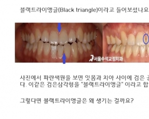 블랙트라이앵…